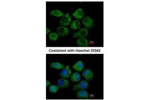 ICC/IF Image Immunofluorescence analysis of paraformaldehyde-fixed A431, using G protein alpha Inhibitor 2, antibody at 1:500 dilution. (GNAI2 antibody  (Center))
