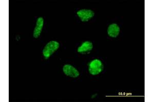Immunofluorescence of purified MaxPab antibody to ZNF302 on HeLa cell.