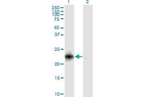 Western Blot analysis of RRAS2 expression in transfected 293T cell line by RRAS2 monoclonal antibody (M01A), clone 2D3-4B8. (RRAS2 antibody  (AA 1-204))