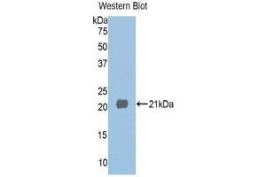 Western Blotting (WB) image for anti-Histone Deacetylase 6 (HDAC6) (AA 1038-1204) antibody (ABIN1859131) (HDAC6 antibody  (AA 1038-1204))