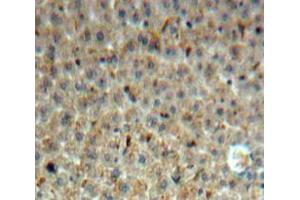 IHC-P analysis of Liver tissue, with DAB staining. (INHBE antibody  (AA 102-344))