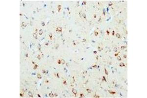 Immunohistochemical analysis of paraffin embedded rat tissue sections (brain), staining NGFbeat in cytoplasm, DAB chromogenic reaction (Nerve Growth Factor antibody  (N-Term))