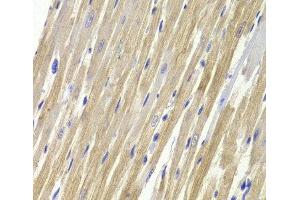 Immunohistochemistry of paraffin-embedded Rat heart using GPD1 Polyclonal Antibody at dilution of 1:100 (40x lens). (GPD1 antibody)