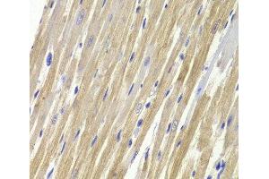 Immunohistochemistry of paraffin-embedded Rat heart using GPD1 Polyclonal Antibody at dilution of 1:100 (40x lens).