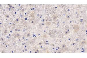 Detection of MCSF in Mouse Cerebellum Tissue using Polyclonal Antibody to Colony Stimulating Factor 1, Macrophage (MCSF) (M-CSF/CSF1 antibody  (AA 261-427))