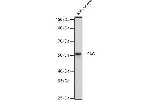 Western blot analysis of extracts of Mouse eye cells, using SAG antibody (ABIN6132558, ABIN6147361, ABIN6147362 and ABIN6216887) at 1:1000 dilution. (SAG antibody  (AA 1-405))