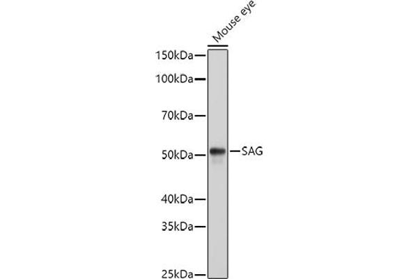 SAG anticorps  (AA 1-405)