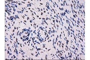 Immunohistochemistry (IHC) image for anti-Sorbitol Dehydrogenase (SORD) antibody (ABIN1501077) (SORD antibody)