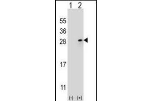 Western blot analysis of FGF9 (arrow) using rabbit polyclonal FGF9 Antibody (N-term) (ABIN654171 and ABIN2844030). (FGF9 antibody  (N-Term))