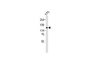 Western blot analysis of lysate from Y79 cell line, using ANKRD24 Antibody (Center) (ABIN6244224 and ABIN6577526). (ANKRD24 antibody  (AA 296-328))