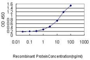 Detection limit for recombinant GST tagged SLC45A2 is approximately 0. (SLC45A2 antibody  (AA 1-243))