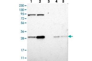 Western blot analysis of Lane 1: RT-4, Lane 2: U-251 MG, Lane 3: Human Plasma, Lane 4: Liver, Lane 5: Tonsil with CLIC4 polyclonal antibody  at 1:250-1:500 dilution.