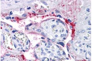 Human Placenta: Formalin-Fixed, Paraffin-Embedded (FFPE) (Integrin beta 3 antibody)
