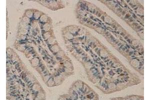 Immunohistochemical staining of formalin-fixed paraffin-embedded human small intestine tissue with ADAM17 polyclonal antibody  at 1 : 100 dilution. (ADAM17 antibody  (C-Term))