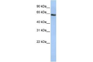 WB Suggested Anti-FANCE Antibody Titration: 0. (FANCE antibody  (Middle Region))