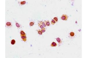 Immunocytochemistry analysis of MCF-7 cells using ABIN7139177 at dilution of 1:100 (HIST1H1E antibody  (acLys33))