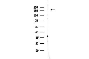 anti-Phosphatidylinositol-4-Phosphate 3-Kinase, Catalytic Subunit Type 2 gamma (PIK3C2G) (C-Term) antibody