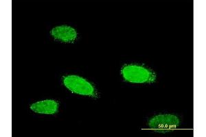 Immunofluorescence of monoclonal antibody to TCFL5 on HeLa cell. (TCFL5 antibody  (AA 418-500))