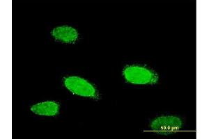 Immunofluorescence of monoclonal antibody to TCFL5 on HeLa cell.