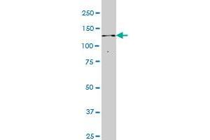 ITPKB monoclonal antibody (M01), clone 2F8 Western Blot analysis of ITPKB expression in Jurkat . (ITPKB antibody  (AA 545-643))