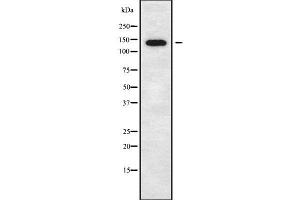 Western blot analysis of CTNND2 using COLO205 whole cell lysates
