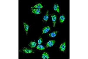 Confocal immunofluorescent analysis of MIC1 Antibody (N-term) (ABIN655711 and ABIN2845162) with MDA-MB cell followed by Alexa Fluor 488-conjugated goat anti-rabbit lgG (green).