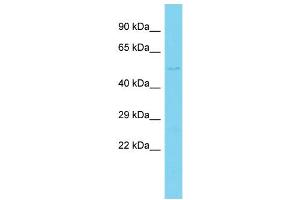 Host: Rabbit  Target Name: Wsb1  Sample Tissue: Rat Heart lysates  Antibody Dilution: 1. (WSB1 antibody  (Middle Region))