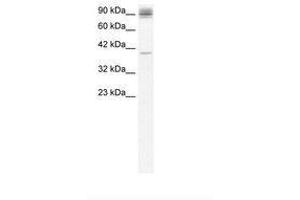 Image no. 3 for anti-Nuclear Factor of kappa Light Polypeptide Gene Enhancer in B-Cells 2 (NFKB2) (AA 711-758) antibody (ABIN6735824) (NFKB2 antibody  (AA 711-758))