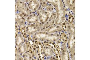 Immunohistochemistry of paraffin-embedded mouse kidney using HIRIP3 antibody at dilution of 1:100 (x400 lens). (HIRIP3 antibody)