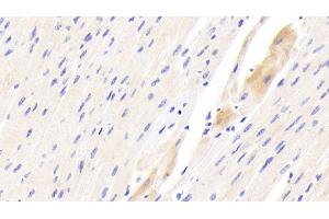 Detection of TSPO in Human Cardiac Muscle Tissue using Polyclonal Antibody to Translocator Protein (TSPO) (TSPO antibody  (AA 1-169))
