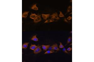 Immunofluorescence analysis of C6 cells using B2 Rabbit pAb (ABIN6127467, ABIN6137310, ABIN6137311 and ABIN6225253) at dilution of 1:100. (ATP1B2 antibody  (AA 68-290))