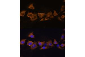 Immunofluorescence analysis of C6 cells using B2 Rabbit pAb (ABIN6127467, ABIN6137310, ABIN6137311 and ABIN6225253) at dilution of 1:100. (ATP1B2 antibody  (AA 68-290))