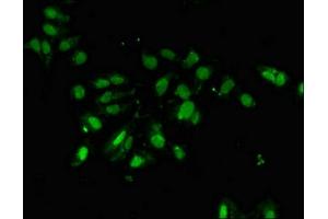 Immunofluorescent analysis of Hela cells using ABIN7162710 at dilution of 1:100 and Alexa Fluor 488-congugated AffiniPure Goat Anti-Rabbit IgG(H+L) (PCID2 antibody  (AA 2-250))
