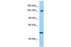 WB Suggested Anti-DIAPH1 Antibody Titration: 1. (DIAPH1 antibody  (C-Term))