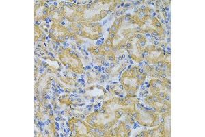 Immunohistochemistry of paraffin-embedded mouse kidney using PGK1 Antibody. (PGK1 antibody  (AA 1-417))