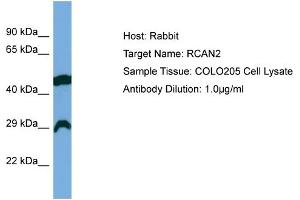 Host: Rabbit Target Name: RCAN2 Sample Type: COLO205 Whole Cell lysates Antibody Dilution: 1. (RCAN2 antibody  (Middle Region))