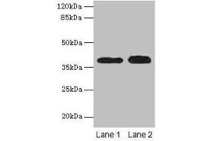 Western blot All lanes: CTSL antibody at 12 μg/mL Lane 1: A549 whole cell lysate Lane 2: HepG2 whole cell lysate Secondary Goat polyclonal to rabbit IgG at 1/10000 dilution Predicted band size: 38 kDa Observed band size: 38 kDa