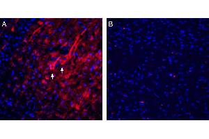 Expression of Homer1 in rat parietal cortex.