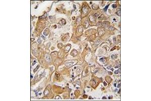 Image no. 2 for anti-Leukocyte Cell Derived Chemotaxin 1 (LECT1) (C-Term) antibody (ABIN357871)