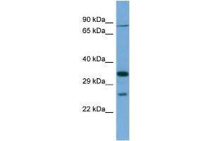 Host:  Rabbit  Target Name:  SLC6A9  Sample Type:  THP-1 Whole cell lysates  Antibody Dilution:  1. (GLYT1 antibody  (N-Term))
