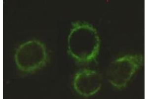 Immunocytochemistry stain of Hela using Pyruvate Dehydrogenase E2 mouse mAb (1:300).