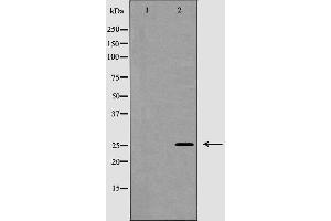 Western blot analysis of NGF beta expression in Jurkat cells,The lane on the left is treated with the antigen-specific peptide. (Nerve Growth Factor antibody  (Internal Region))
