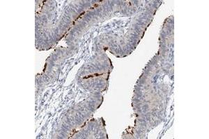 Immunohistochemical staining of human fallopian tube with DNAH5 polyclonal antibody  shows distinct positivity in the cilia at 1:10-1:20 dilution.