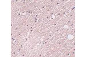 Immunohistochemistry of FRMPD4 in human brain tissue with FRMPD4 antibody at 5 μg/ml. (FRMPD4 antibody  (Center))