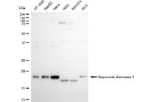 Western blotting analysis using superoxide dismutase 1 antibody (ABIN7800461). (Recombinant SOD1 antibody)