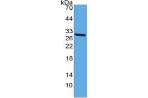 WB of Protein Standard: different control antibodies against Highly purified E. (alpha 2 Macroglobulin ELISA Kit)