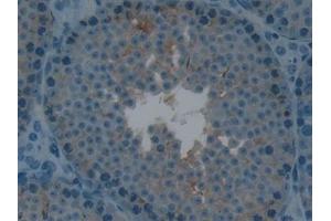 Detection of LTbR in Mouse Testis Tissue using Polyclonal Antibody to Lymphotoxin Beta Receptor (LTbR) (LTBR antibody  (AA 128-395))