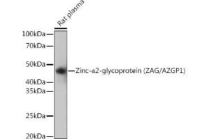 Western blot analysis of extracts of Rat plasma, using Zinc-α2-glycoprotein (ZAG/) Rabbit mAb (ABIN7265556) at 1:1000 dilution. (AZGP1 antibody)