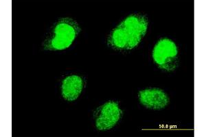 Immunofluorescence of monoclonal antibody to PAX7 on HeLa cell. (PAX7 antibody  (AA 411-520))