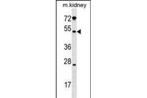 GALNT13 antibody  (AA 252-281)
